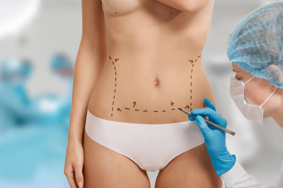 Liposuction in a clinic setting