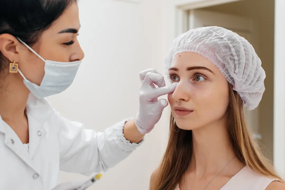 Rhinoplasty in a clinic setting